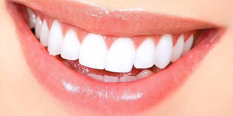  LAMINATE VENEERS AND SMILE DESIGN