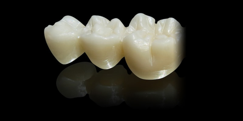 Zirconia Restorations