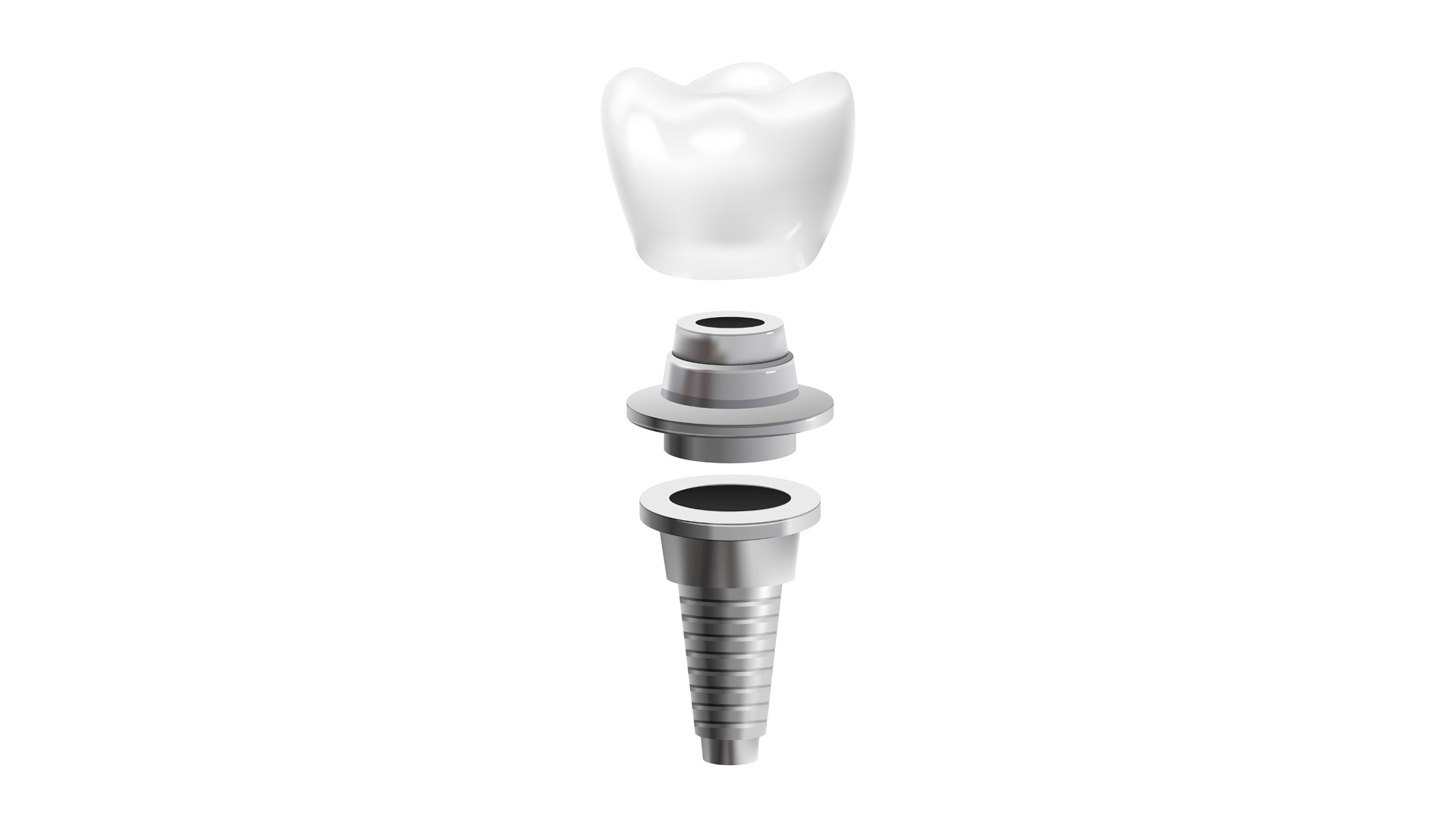 Implant Treatments