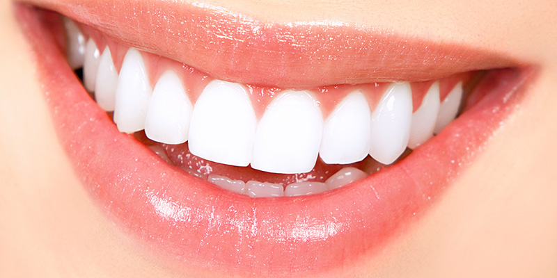 Teeth Whitening