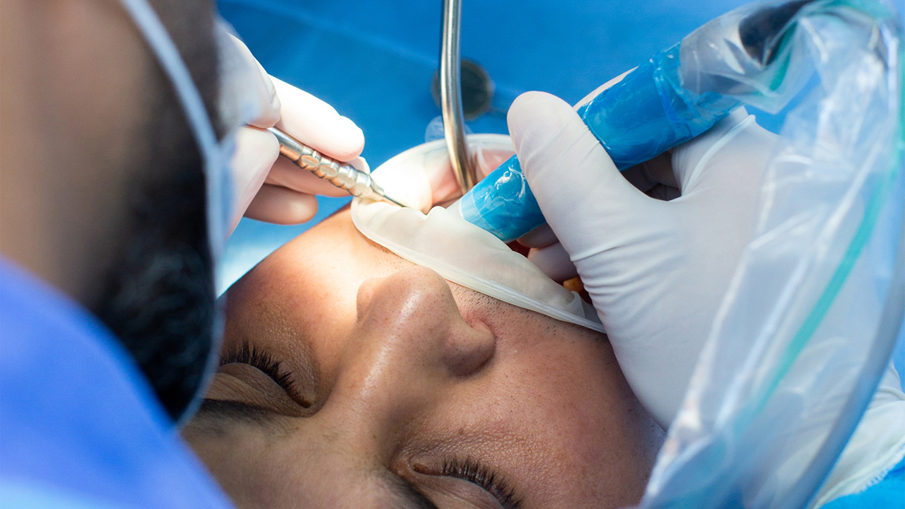 General Anaesthesia: A Professional Overview