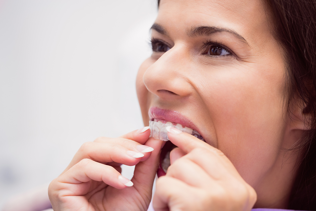 Teeth Grinding: Causes, Symptoms, and Treatment